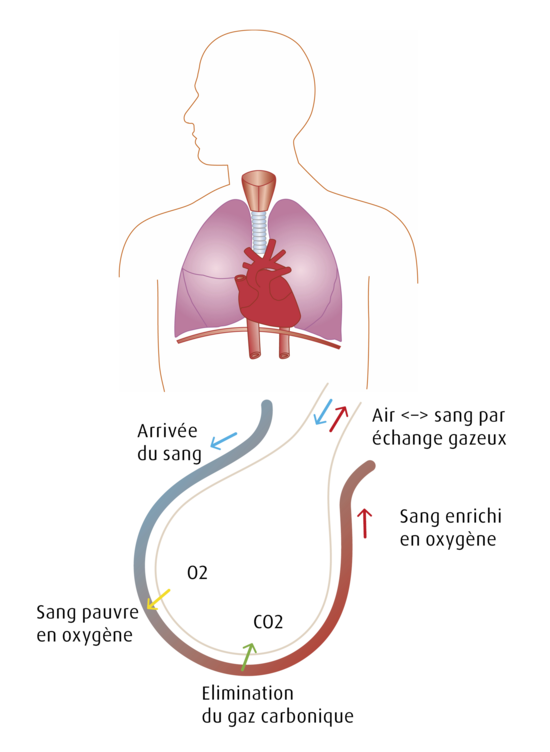 ventilation assistee illustration